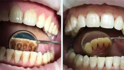 Стоматологическая клиника WELL CLINIC на проспекте Космонавтов изображение 14