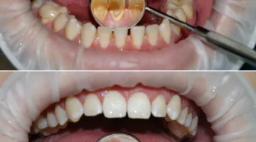 Стоматологическая клиника WELL CLINIC на проспекте Космонавтов изображение 13