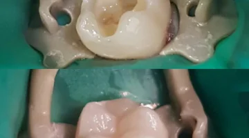 Стоматологическая клиника WELL CLINIC на проспекте Космонавтов изображение 9