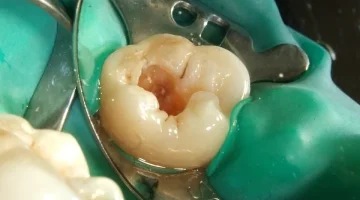 Стоматологическая клиника WELL CLINIC на проспекте Космонавтов изображение 12
