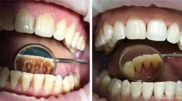 Стоматологическая клиника WELL CLINIC на проспекте Космонавтов изображение 8